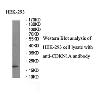 CDKN1A Rabbit Polyclonal Antibody