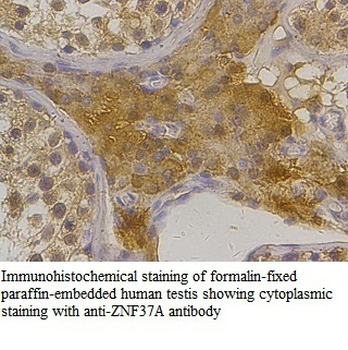 ZNF37A Rabbit Polyclonal Antibody
