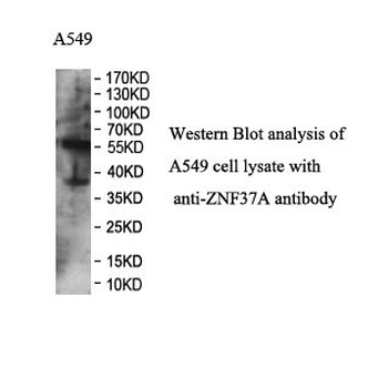 ZNF37A Rabbit Polyclonal Antibody