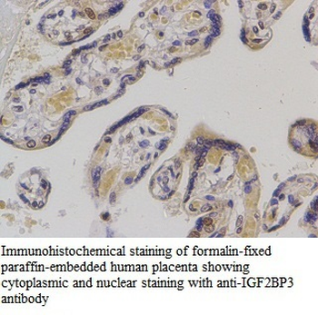 IGF2BP3 Rabbit Polyclonal Antibody