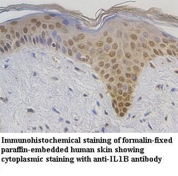 IL1B Rabbit Polyclonal Antibody