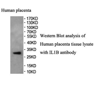 IL1B Rabbit Polyclonal Antibody