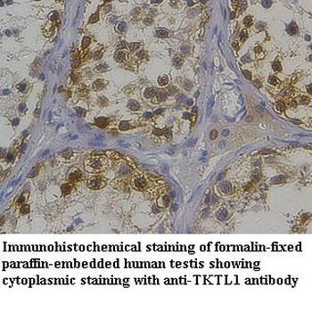 TKTL1 Rabbit Polyclonal Antibody