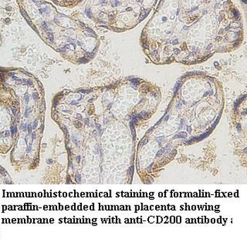 CD200 Rabbit Polyclonal Antibody