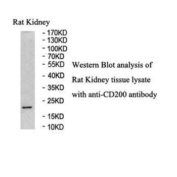 CD200 Rabbit Polyclonal Antibody
