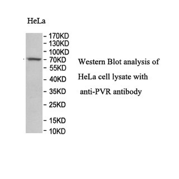 PVR Rabbit Polyclonal Antibody