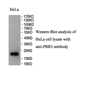PRR3 Rabbit Polyclonal Antibody