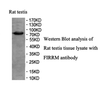 C1orf112 Rabbit Polyclonal Antibody