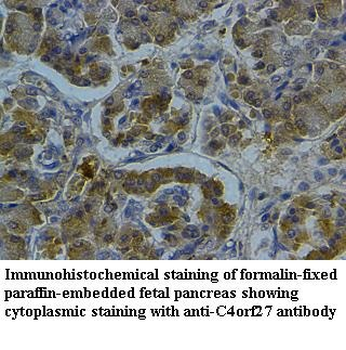 HPF1 Rabbit Polyclonal Antibody