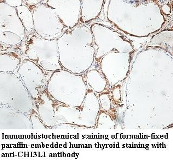 CHI3L1 Rabbit Polyclonal Antibody