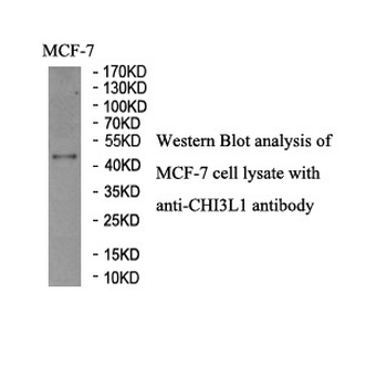 CHI3L1 Rabbit Polyclonal Antibody