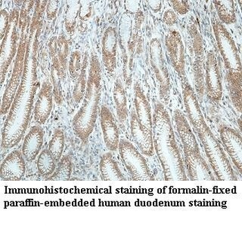 FAM46B Rabbit Polyclonal Antibody