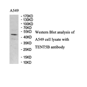 FAM46B Rabbit Polyclonal Antibody