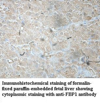 FBP1 Rabbit Polyclonal Antibody