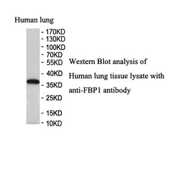 FBP1 Rabbit Polyclonal Antibody
