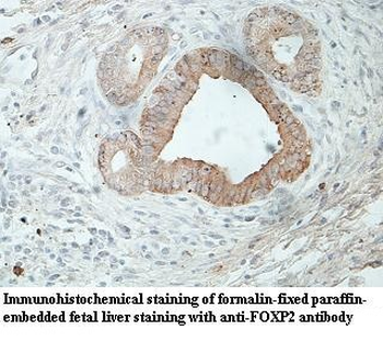 FOXP2 Rabbit Polyclonal Antibody