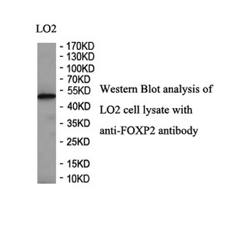 FOXP2 Rabbit Polyclonal Antibody