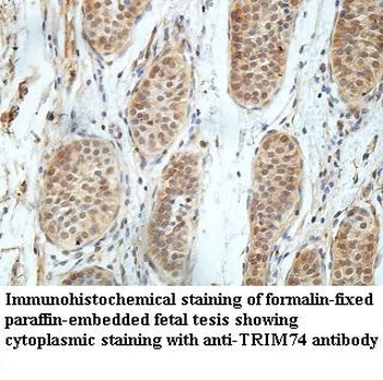 TRIM74 Rabbit Polyclonal Antibody
