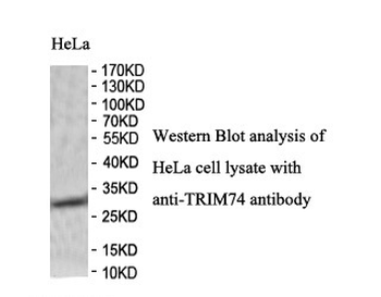 TRIM74 Rabbit Polyclonal Antibody