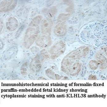 KLHL38 Rabbit Polyclonal Antibody