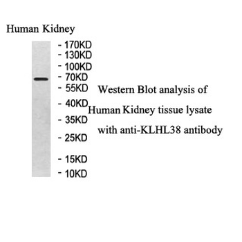 KLHL38 Rabbit Polyclonal Antibody