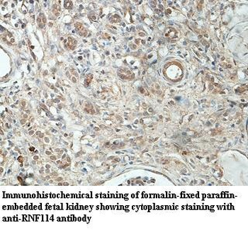 RNF114 Rabbit Polyclonal Antibody