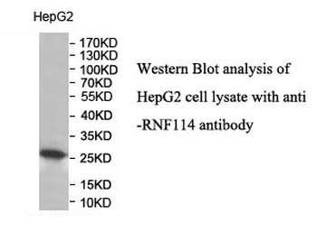 RNF114 Rabbit Polyclonal Antibody