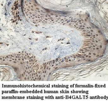 B4GALT5 Rabbit Polyclonal Antibody