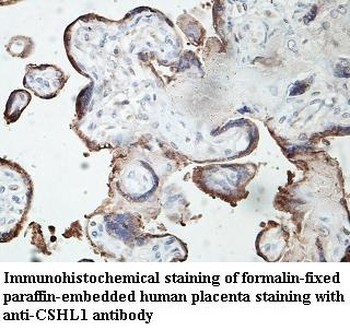 CSHL1 Rabbit Polyclonal Antibody