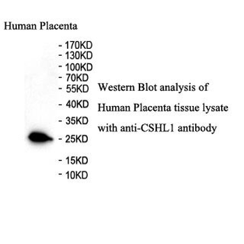 CSHL1 Rabbit Polyclonal Antibody