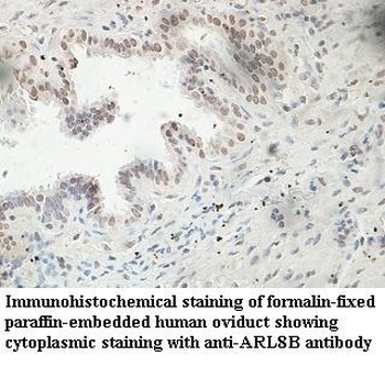 ARL8B Rabbit Polyclonal Antibody