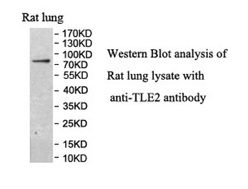 TLE2 Rabbit Polyclonal Antibody