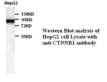 CTNNB1 Rabbit Polyclonal Antibody