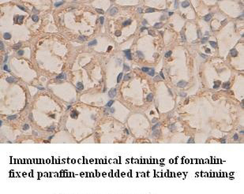 Plexin-B1 Rabbit Polyclonal Antibody