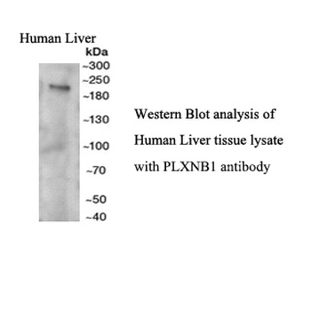 Plexin-B1 Rabbit Polyclonal Antibody