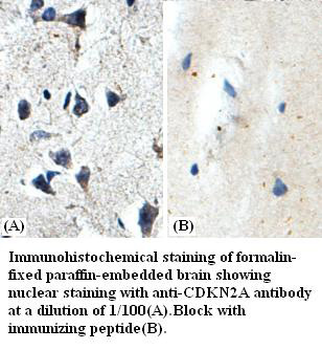 CDKN2A Rabbit Polyclonal Antibody