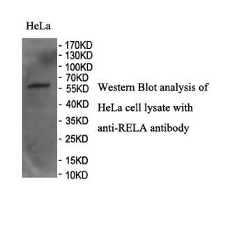 RELA Rabbit Polyclonal Antibody