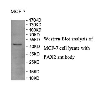 PAX2 Rabbit Polyclonal Antibody