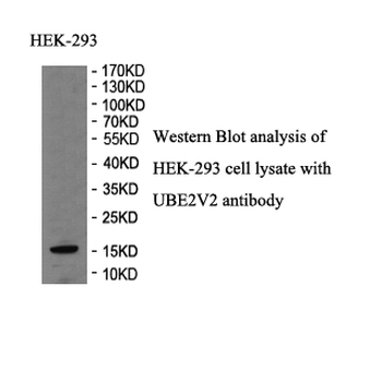 UBE2V2 Rabbit Polyclonal Antibody