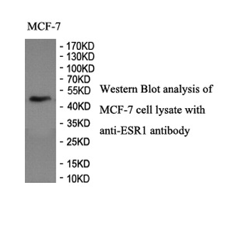 ESR1 Rabbit Polyclonal Antibody
