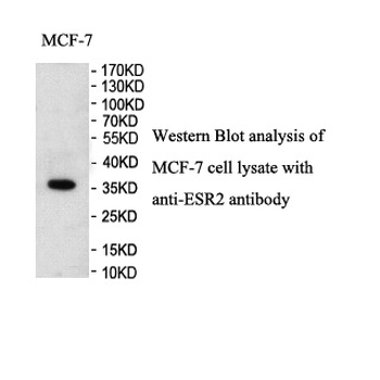 ESR2 Rabbit Polyclonal Antibody
