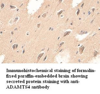 ADAMTS4 Rabbit Polyclonal Antibody