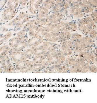 ADAM15 Rabbit Polyclonal Antibody
