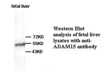 ADAM15 Rabbit Polyclonal Antibody