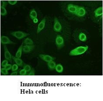 AKR1C3 Rabbit Polyclonal Antibody