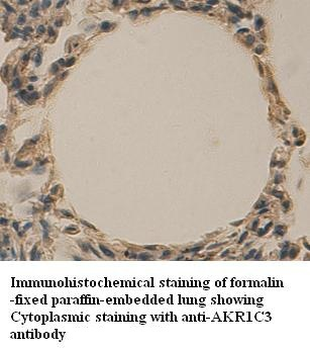 AKR1C3 Rabbit Polyclonal Antibody