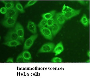 AKT1 Rabbit Polyclonal Antibody