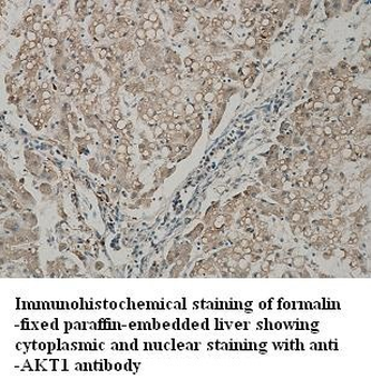 AKT1 Rabbit Polyclonal Antibody