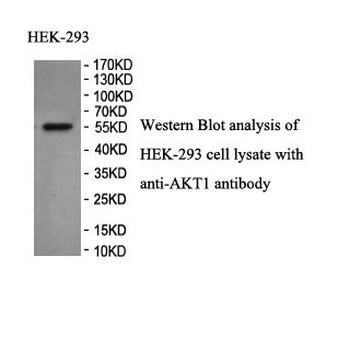 AKT1 Rabbit Polyclonal Antibody
