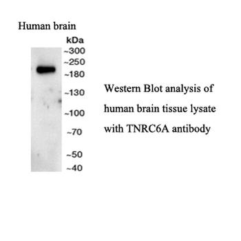 TNRC6A Rabbit Polyclonal Antibody